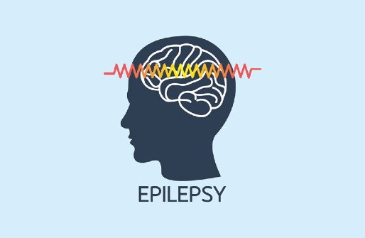 Epilepsy